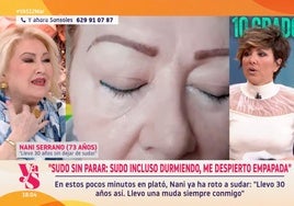 La tortura de padecer hiperhidrosis, el drama de sudar constantemente: «¡Llevo un secador de pelo y una toalla en el bolso!»