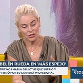 Belén Rueda se sincera sobre el ictus que sufrió y revela las tres «cosas» que hay que hacer: «Te pueden salvar la vida»
