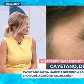 La exclusiva de Susanna Griso que daría un vuelco al caso de Cayetano Rivera: «Como es muy crítico con el Gobierno...»