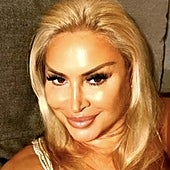 Raquel Mosquera reaparece con «nueva cara» para desvelar qué hay tras su evidente cambio físico