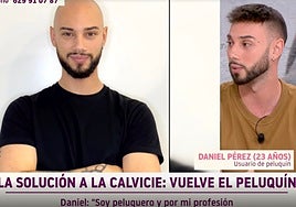 De los injertos de pelo a las prótesis capilares: «Tengo 23 años y llevo peluquín»
