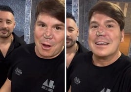 La doctora Yomil Genere explica qué es lo que se ha puesto Lucas, de Andy y Lucas, en su nariz: «Es un cambio estructural tras una cirugía»