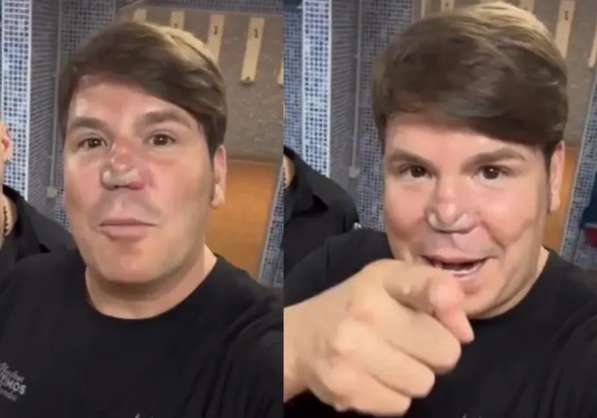 Lucas muestra la tira nasal adhesiva de su nariz