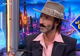 Leiva narra el accidente en el que perdió el ojo a los 12 años: «Me dispararon con una pistola»