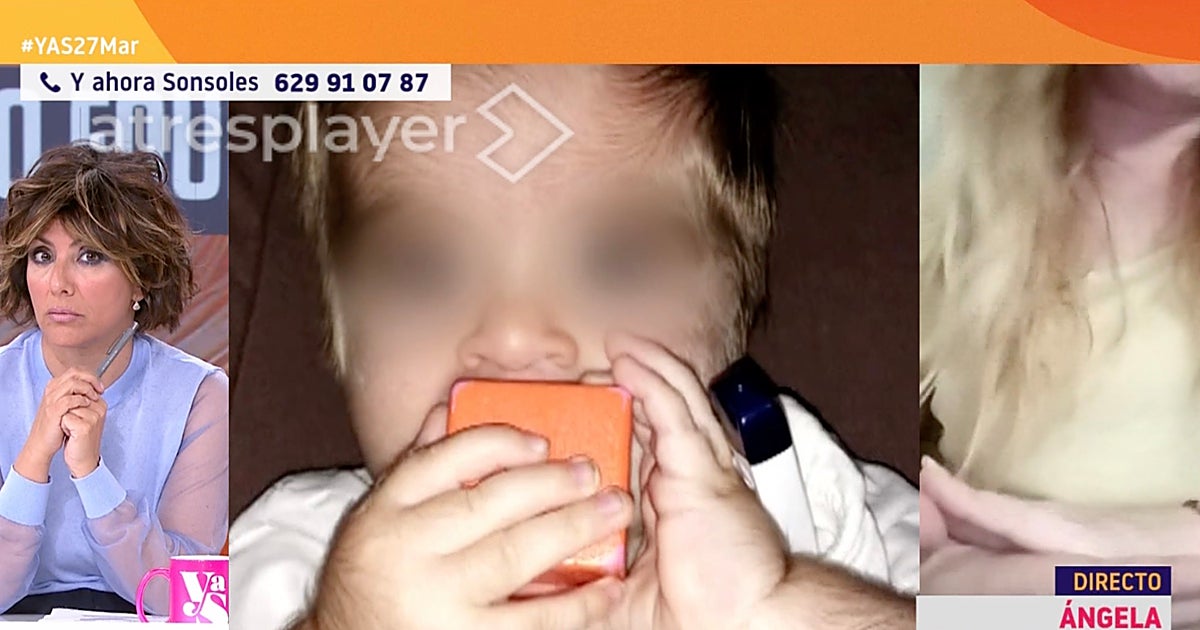 Ángela, madre de un niño con 'síndrome del hombre lobo': «Se lo ha generado un medicamento»