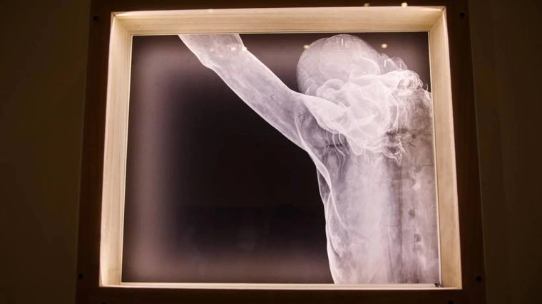 Una de las radiografías de la exposición