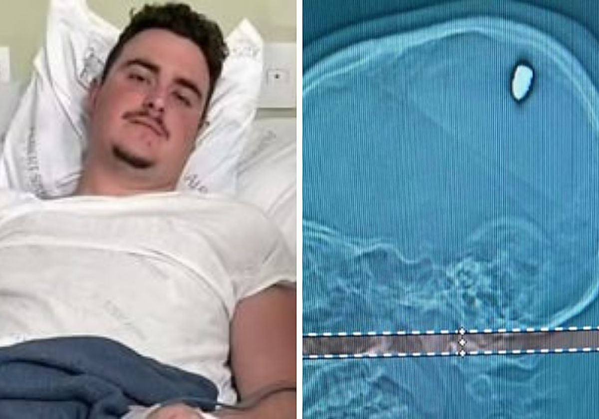 El 31 de diciembre, Mateus Facio recibió un disparo pero interpretó la experiencia como un golpe con una piedra en la cabeza