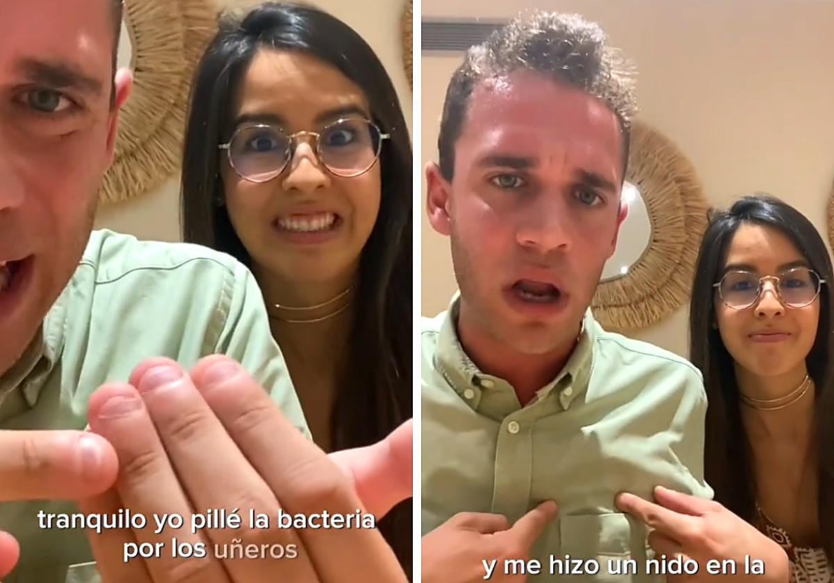 Un joven relata cómo tuvo que ser operado del corazón por comerse las uñas: «Me dieron embolias en el cerebro»