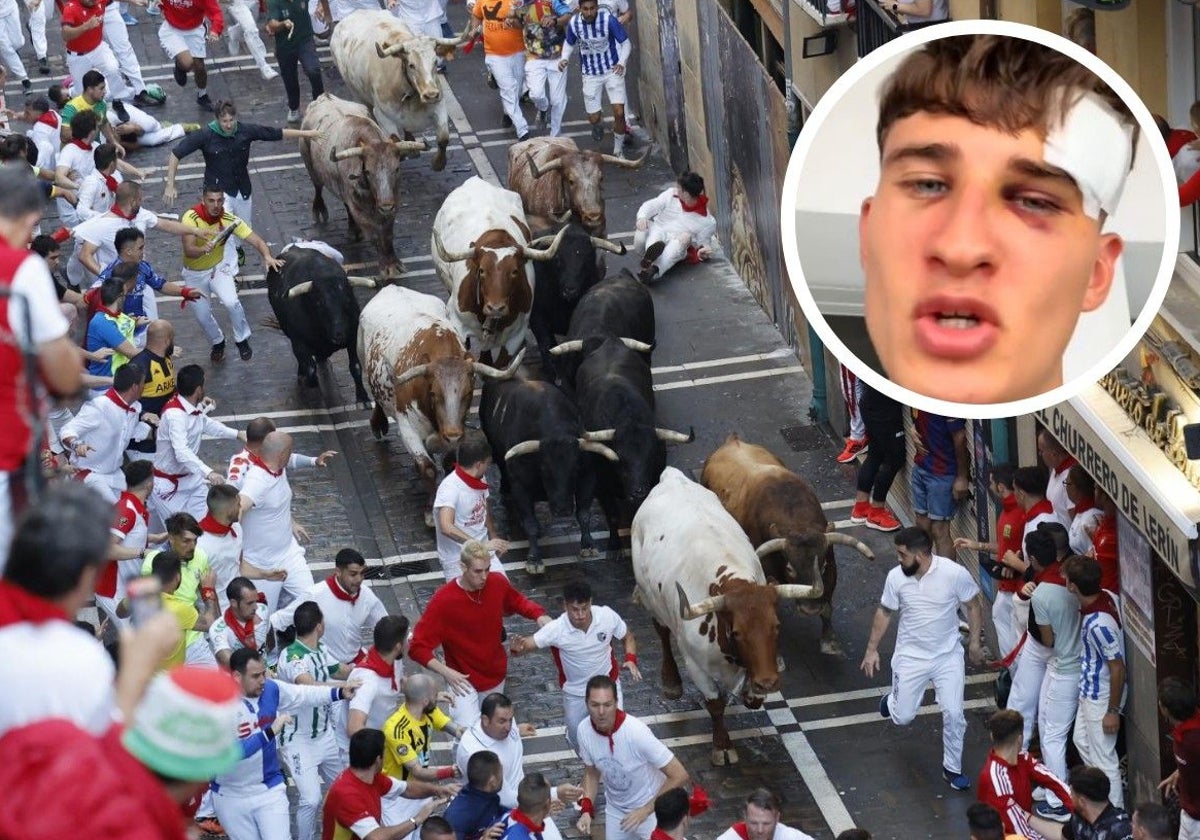 Un catalán herido por un toro en un encierro de San Fermín opina sin filtros sobre las fiestas de Pamplona: «Es lo más loco de mi vida»