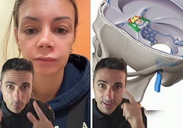 Un técnico de emergencias avisa a los que se aplastan granos en la cara: «Puede quedarse paralizada»