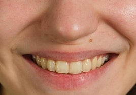 Un odontólogo explica por qué los dientes pueden verse amarillos incluso si se cepillan correctamente: «No es falta de higiene»