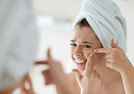 Una enfermera dermoestética explica cómo eliminar las manchas de acné: «Si no dejas de...»