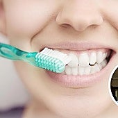Un enfermero señala el tiempo que tiene que pasar para lavarse los dientes después de una comida