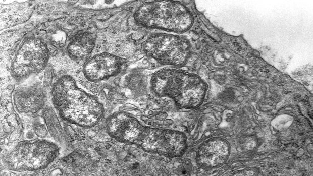 Las bacterias que causan el tifus son cada vez más resistentes a los antibióticos