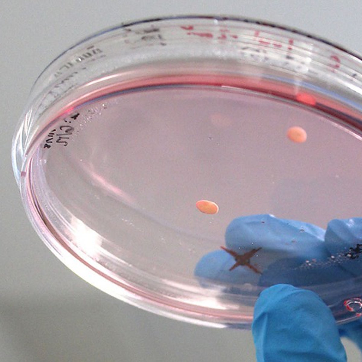 Organoides cultivados en laboratorio revelan información sobre el autismo