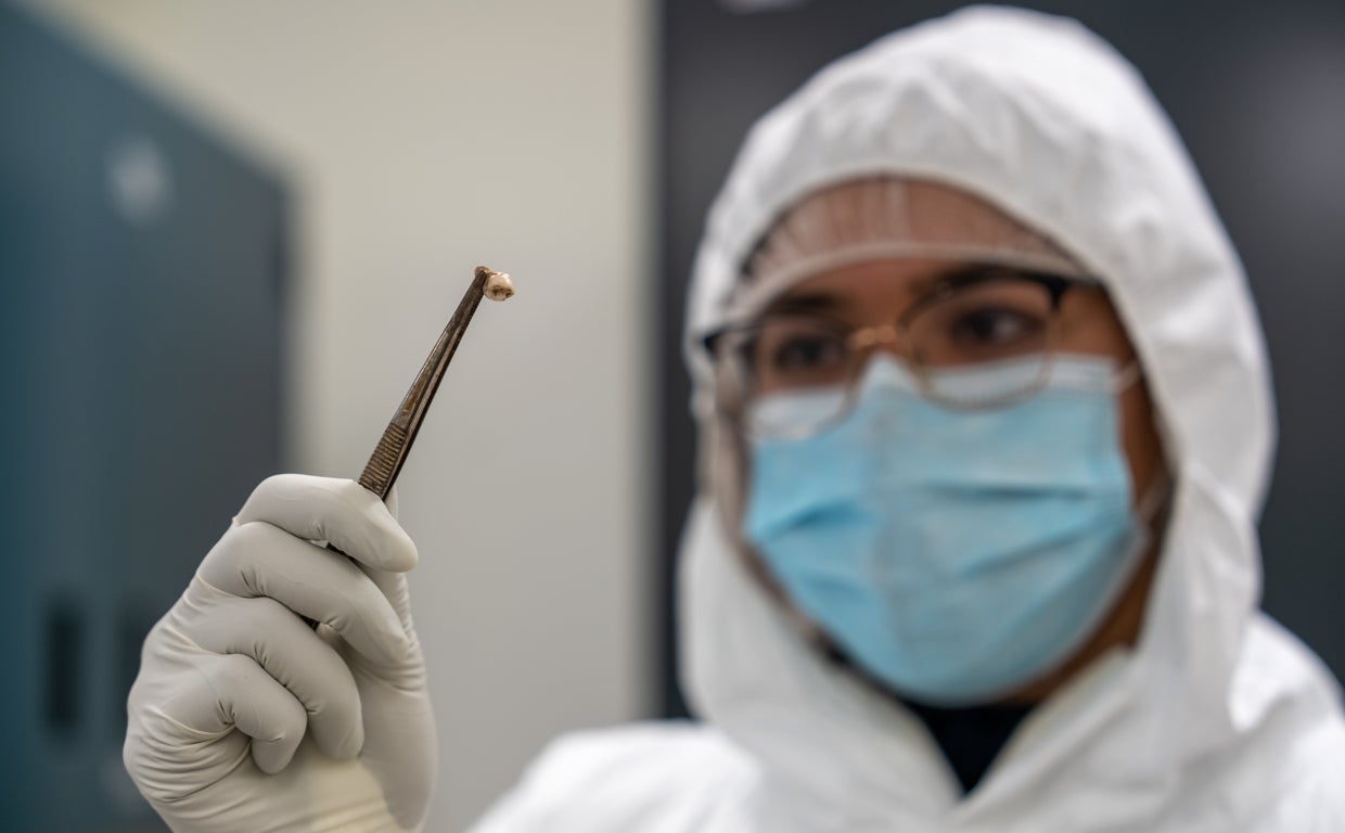 El ADN se extrajo de la dentaduras
