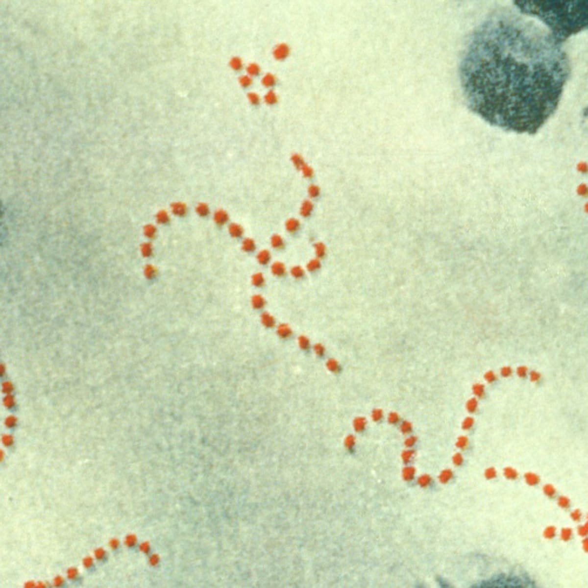 ¿Qué es la bacteria estreptococo A que ha matado a 9 niños en Reino Unido?