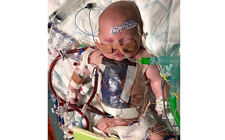 Imagen principal - Finley es la primera persona en someterse a este tratamiento en Reino Unido. Abajo se le ve sonriente en su jardín y en los brazos del doctor Caputo