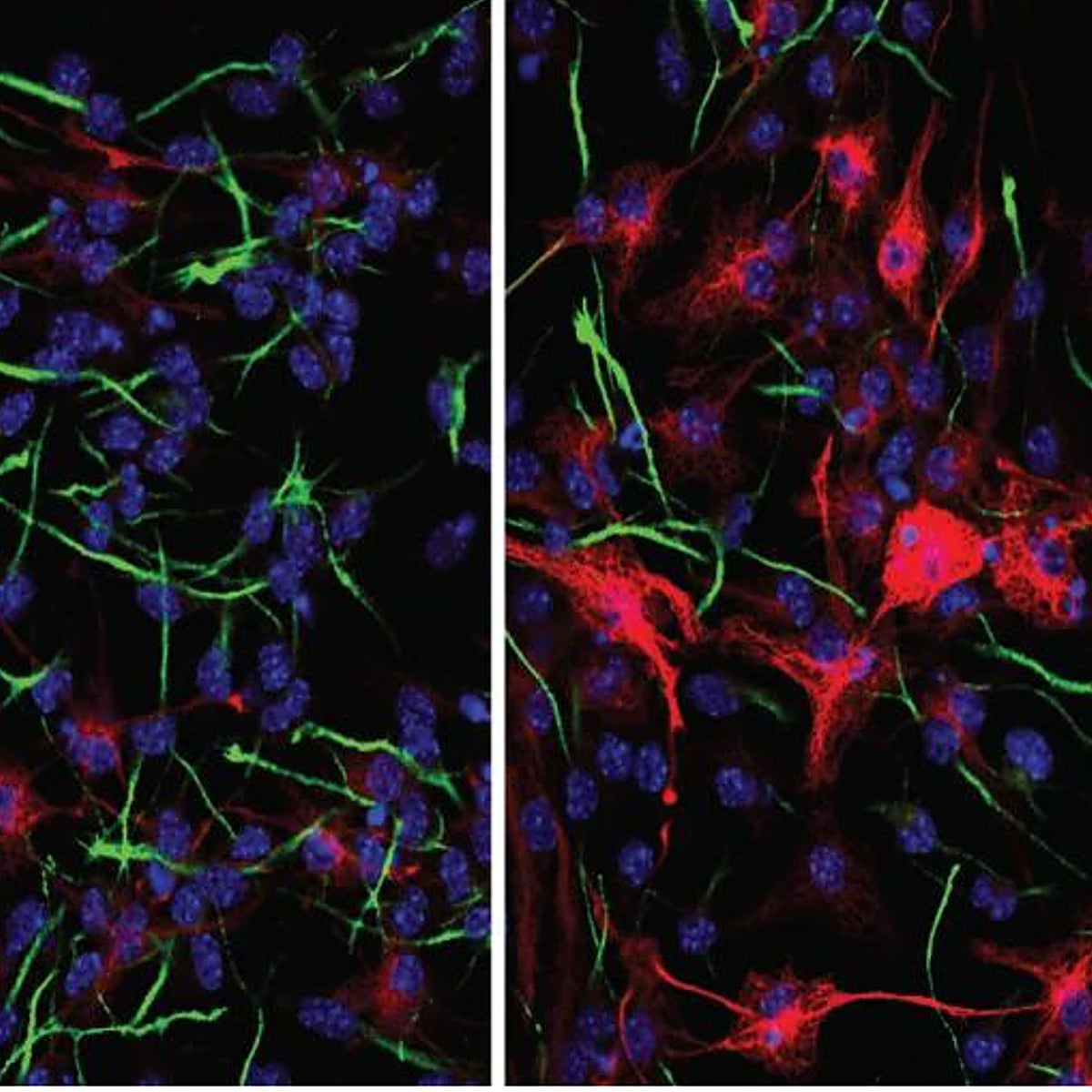 BRD8, el punto débil del cáncer cerebral más mortal