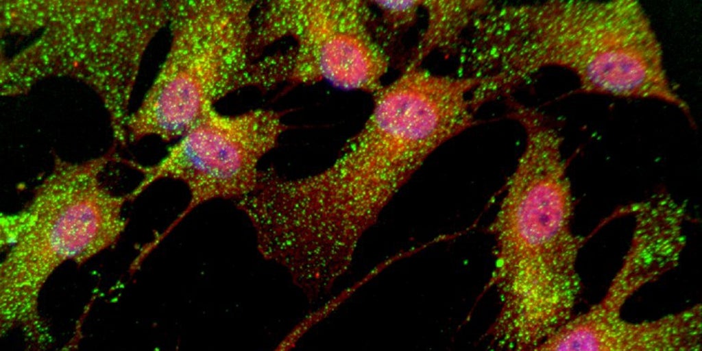 Stem cells used to design drugs for schizophrenia TIme News