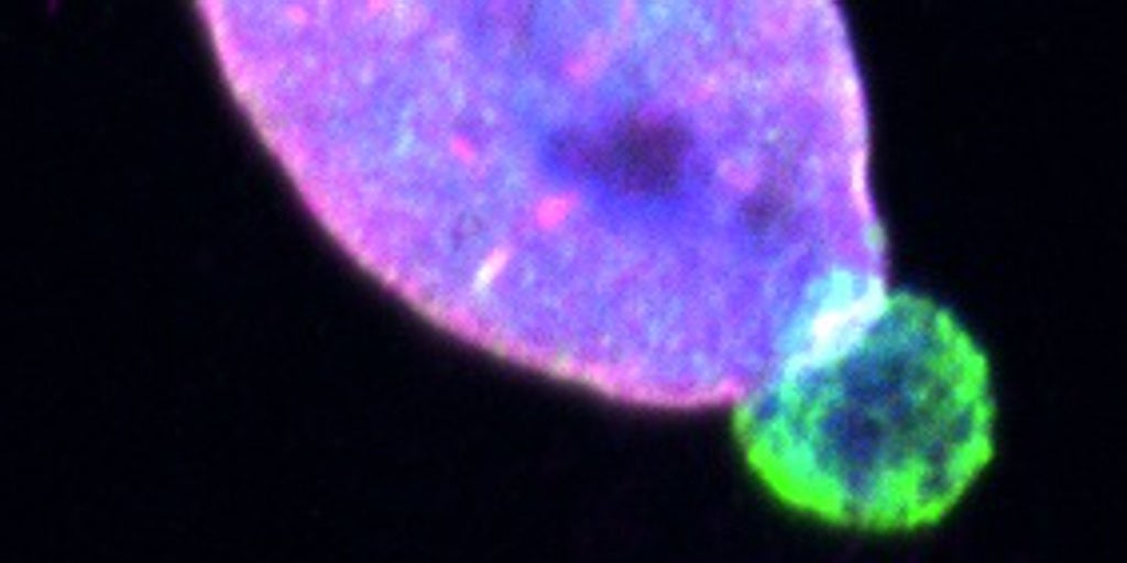 Esta proteína como el melanoma se propaga por toda la piel