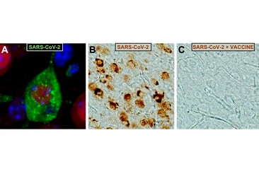 La vacuna del CNB-CSIC protege del covid-19 y del daño cerebral causado