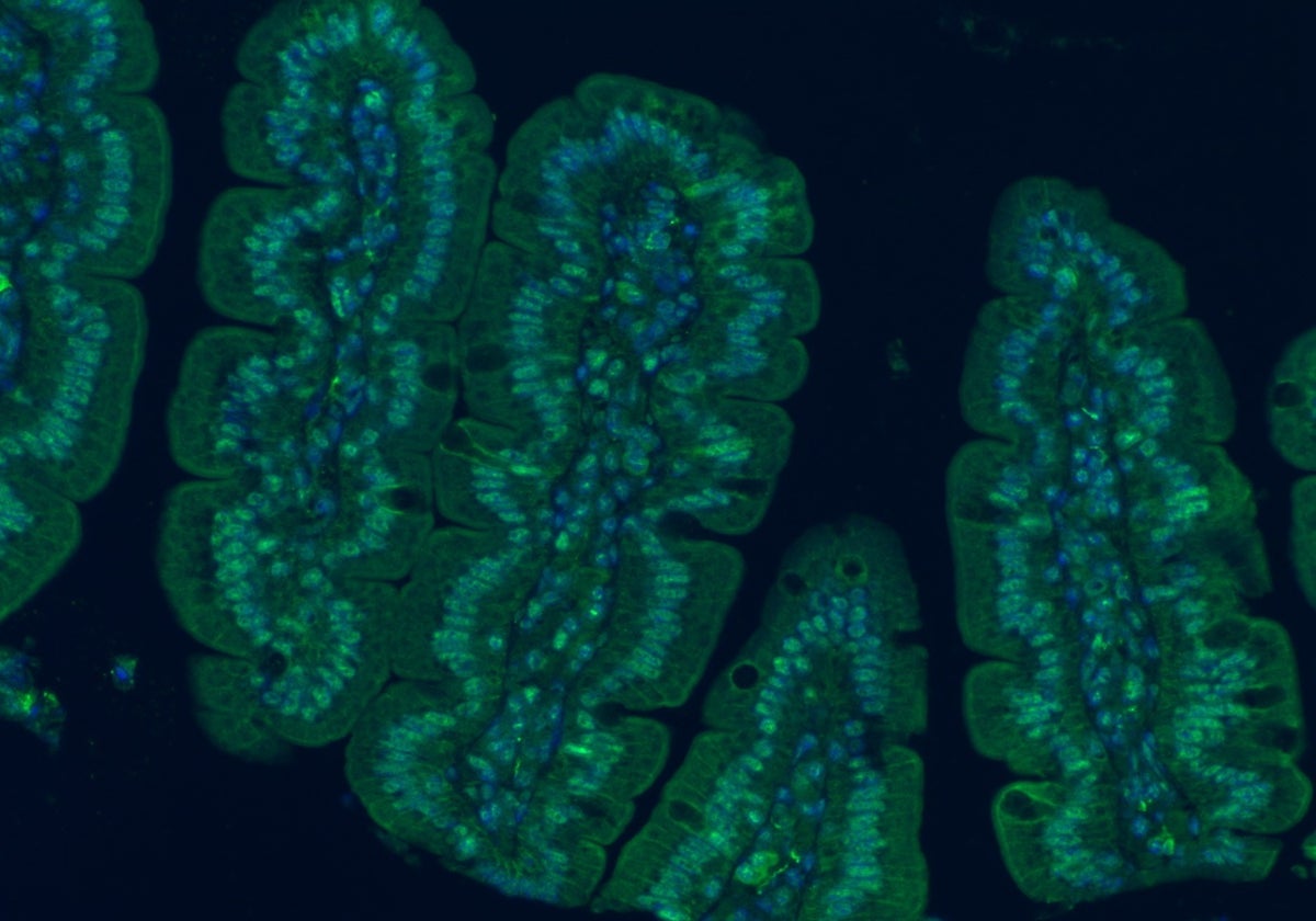 Flora intestinal