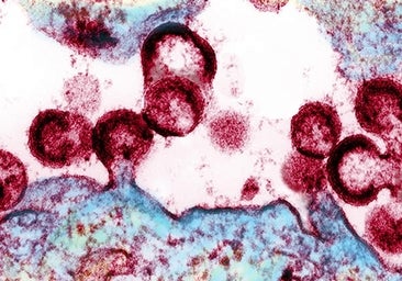 Fracasa la vacuna más esperanzadora para el sida