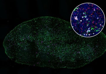 Explican por qué el cáncer de pulmón no responde bien a la inmunoterapia