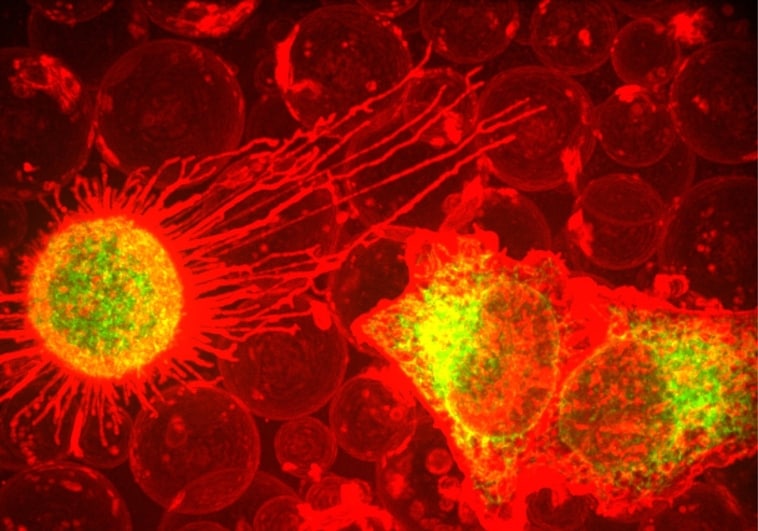 El desconocido mecanismo de muerte celular que elimina el cáncer