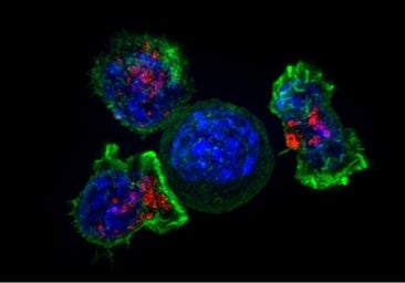 Un proyecto español diseña gemelos virtuales para tratar a niños con leucemia