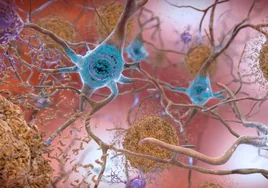La última promesa contra el alzhéimer: Eli Lilly dice que su fármaco frena la enfermedad en etapas tempranas
