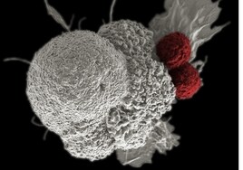 Dos estudios desvelan los secretos y debilidades de la metástasis en cáncer