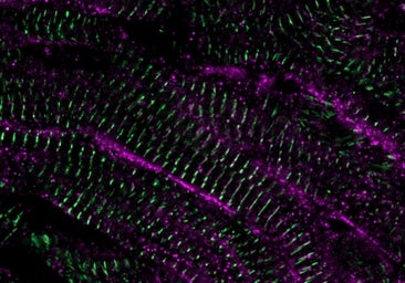 Esta molécula es clave para reparar un corazón dañado tras un infarto