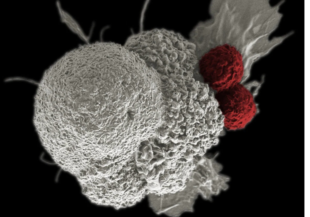 A single drug improves survival in metastatic colon cancer
