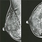 EE.UU. y Europa cambian sus recomendaciones para la primera mamografía: ¿Cuándo hay que hacerla entonces?
