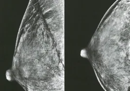 EE.UU. y Europa cambian sus recomendaciones para la primera mamografía: ¿Cuándo hay que hacerla entonces?