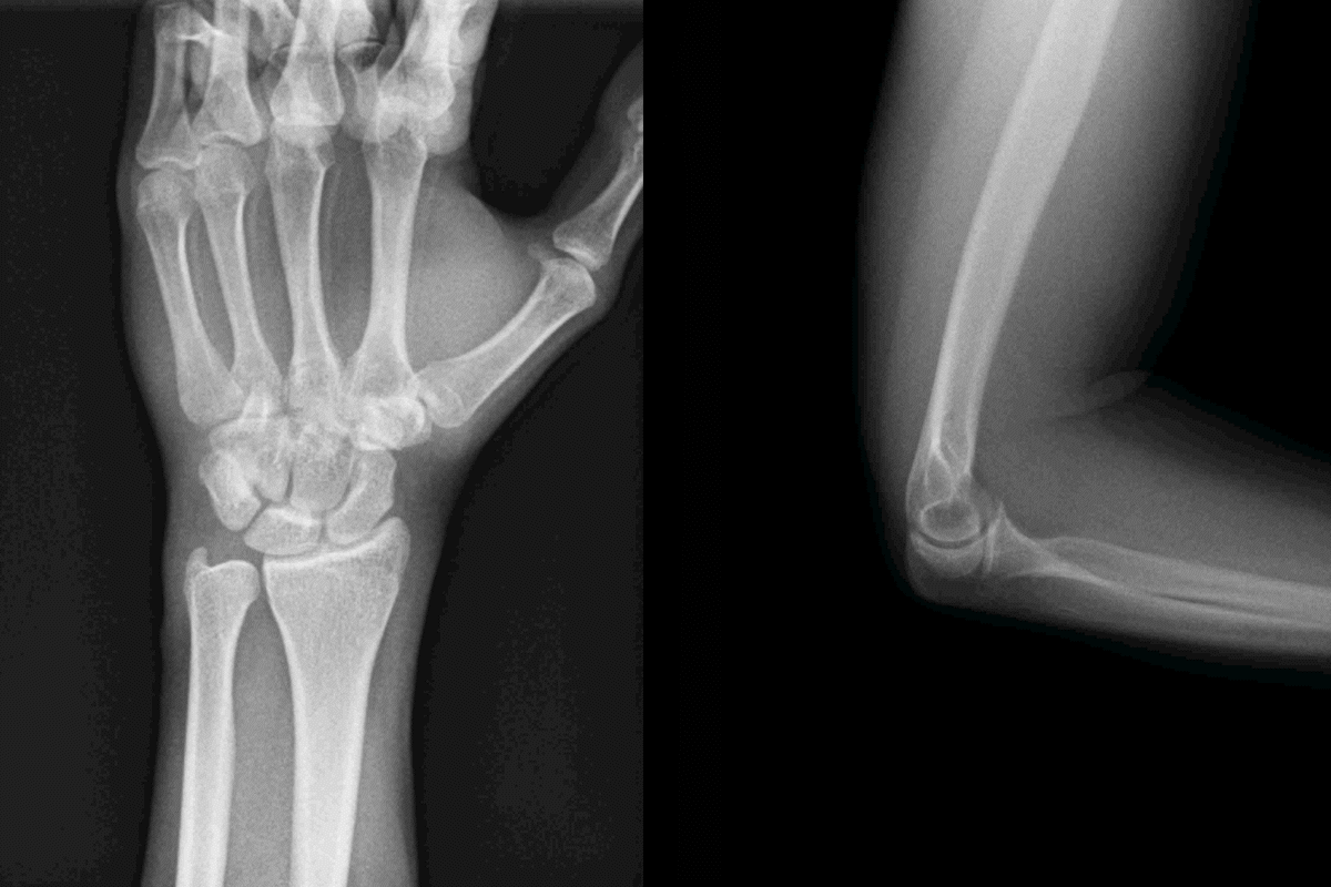 Abc Radiografía Radiografía digital dinámica, cómo ser más precisos en el diagnóstico ...