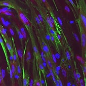 La edición genética corrige una distrofia muscular en el laboratorio y abre la puerta a su reparación