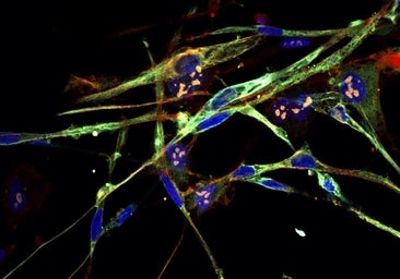 Convierten células cancerosas en células musculares sanas