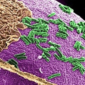 Esta bacteria intestinal nos protege de la obesidad y la diabetes tipo 2