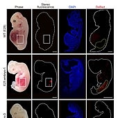 Cultivan por primera vez en un cerdo un órgano humano para trasplante