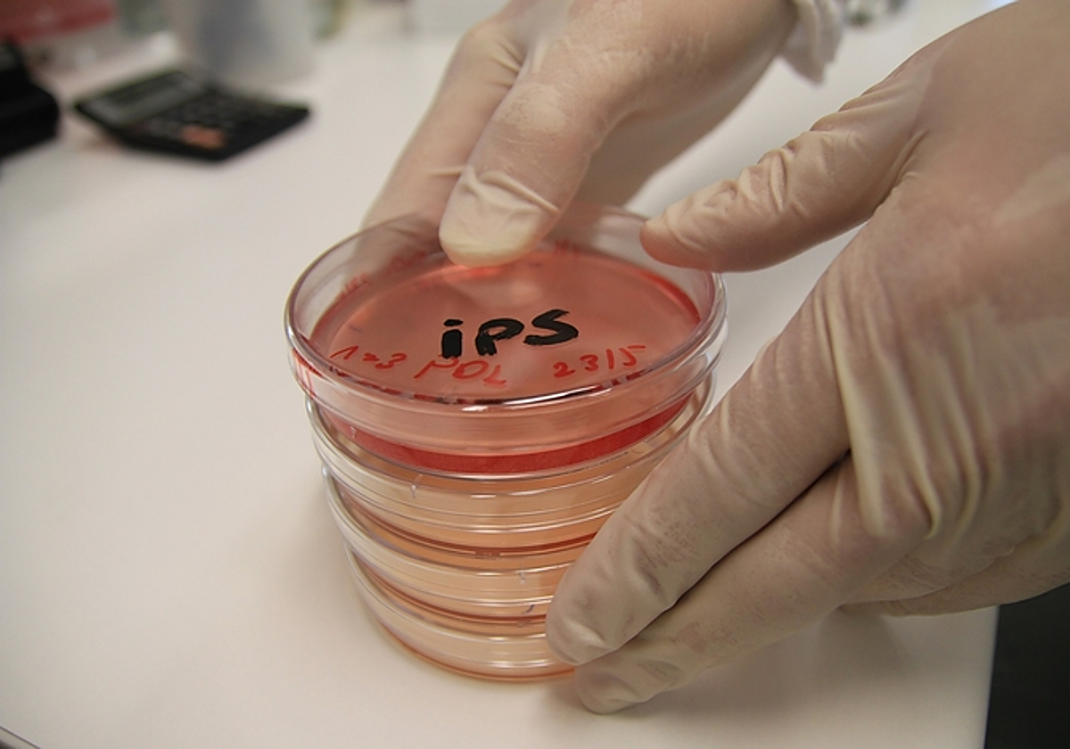 La EPOC necesita desesperadamente tratamientos nuevos y más eficaces