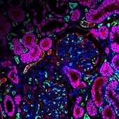 Humanizan riñones de cerdo con edición genética para su uso en trasplantes