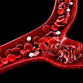 El primer tratamiento con edición genética supera su primer examen: «Es una esperanza para muchas enfermedades genéticas»
