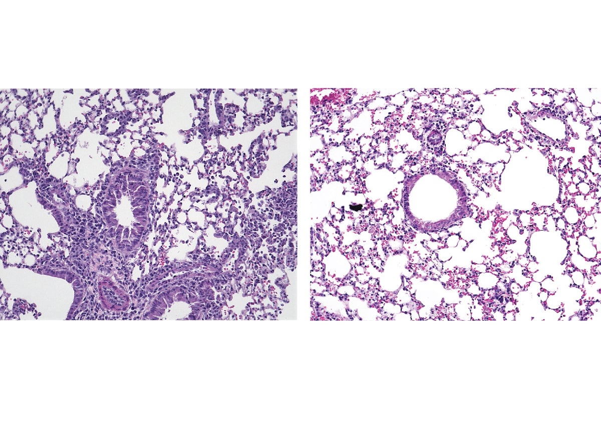 La activación de las ILC2 provoca inflamación en los pulmones del ratón (izquierda), pero esto se reduce mediante el tratamiento con Yoda1 para estimular los canales Piezo1 (derecha).