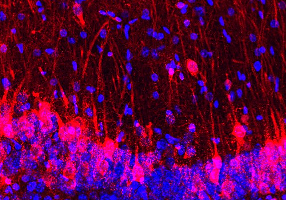 Hipocampo de ratón con células de rata (rojo) y núcleos de células de ratón y de rata (azul).