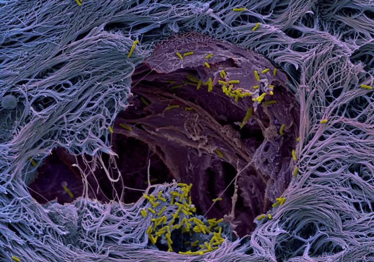 La bacteria patógena Pseudomonas aeruginosa atravesando los epitelios respiratorios de un modelo de microtejido pulmonar humano, capturada mediante microscopía electrónica de barrido