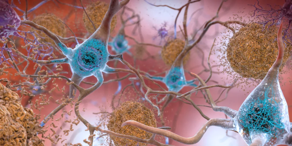 Possible advances in Alzheimer's treatment: study reveals rejuvenating effect of stem cells.