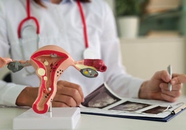 Una de cada diez mujeres padece endometriosis